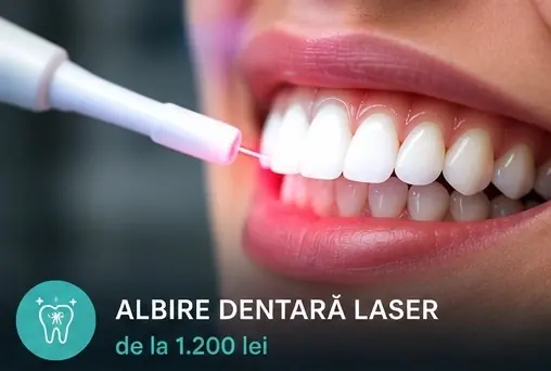 Albire dentară la ProDent Cluj