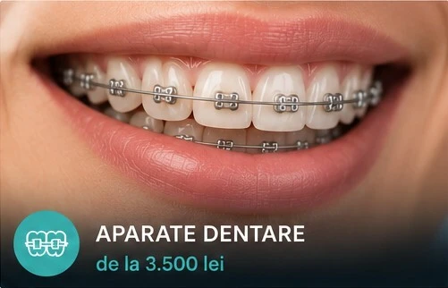 Aparate dentare la ProDent Cluj