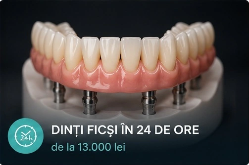 Dinți ficși în 24 de ore la ProDent Cluj