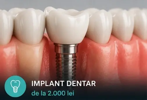 Implant dentar la ProDent Cluj