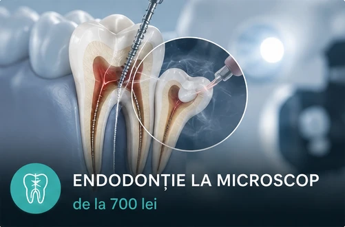 Endodonție la microscop la ProDent Cluj
